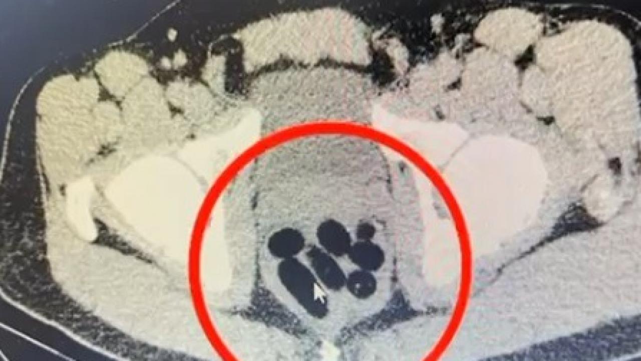 kayseride uyusturucu operasyonu midesinden cikan soke etti OyJ3Hnff.jpg